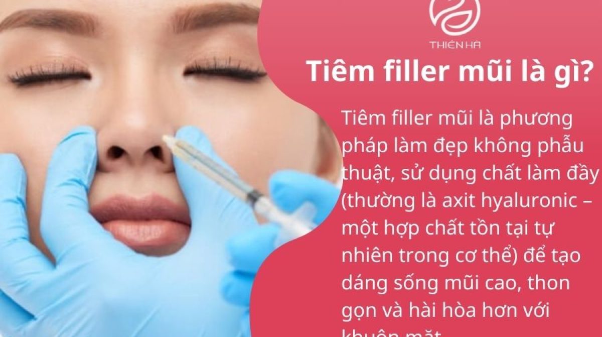 Có nên tiêm filler mũi không? Ưu nhược điểm & Lưu ý quan trọng
