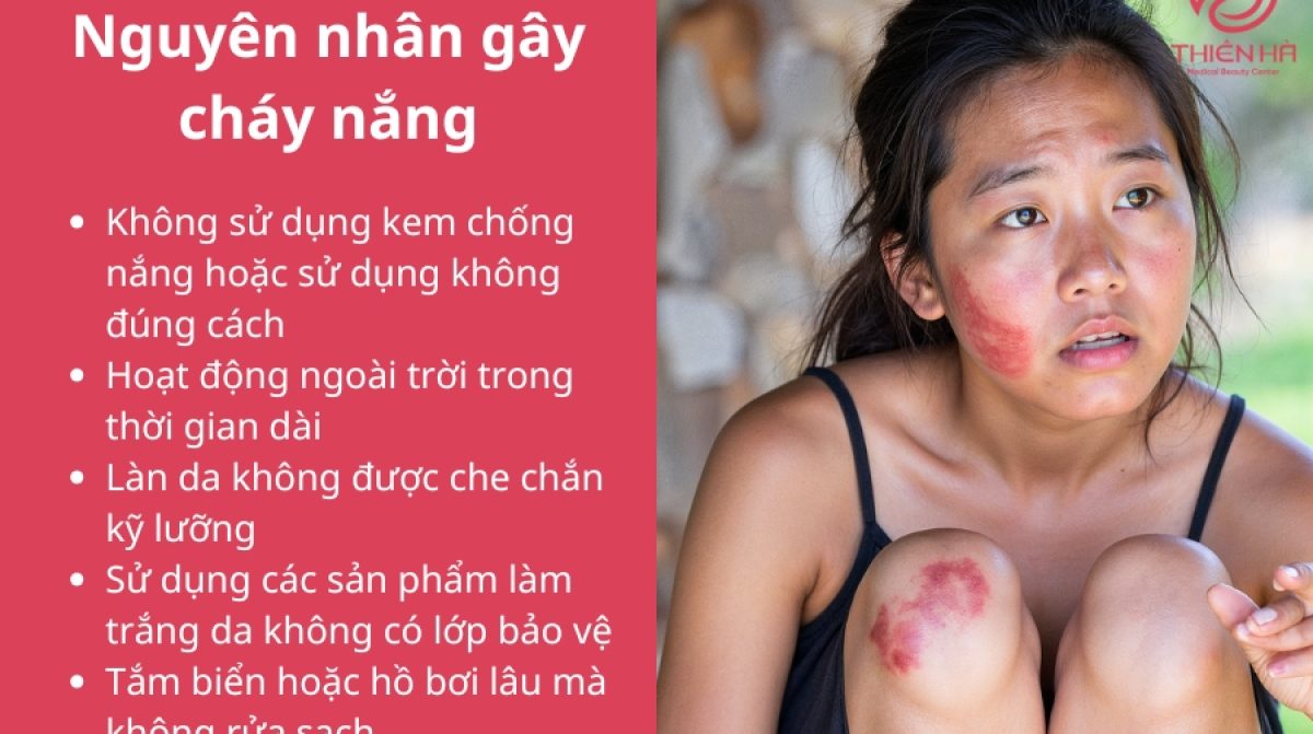 [Giải đáp] Da mặt bị cháy nắng làm sao để trắng lại?