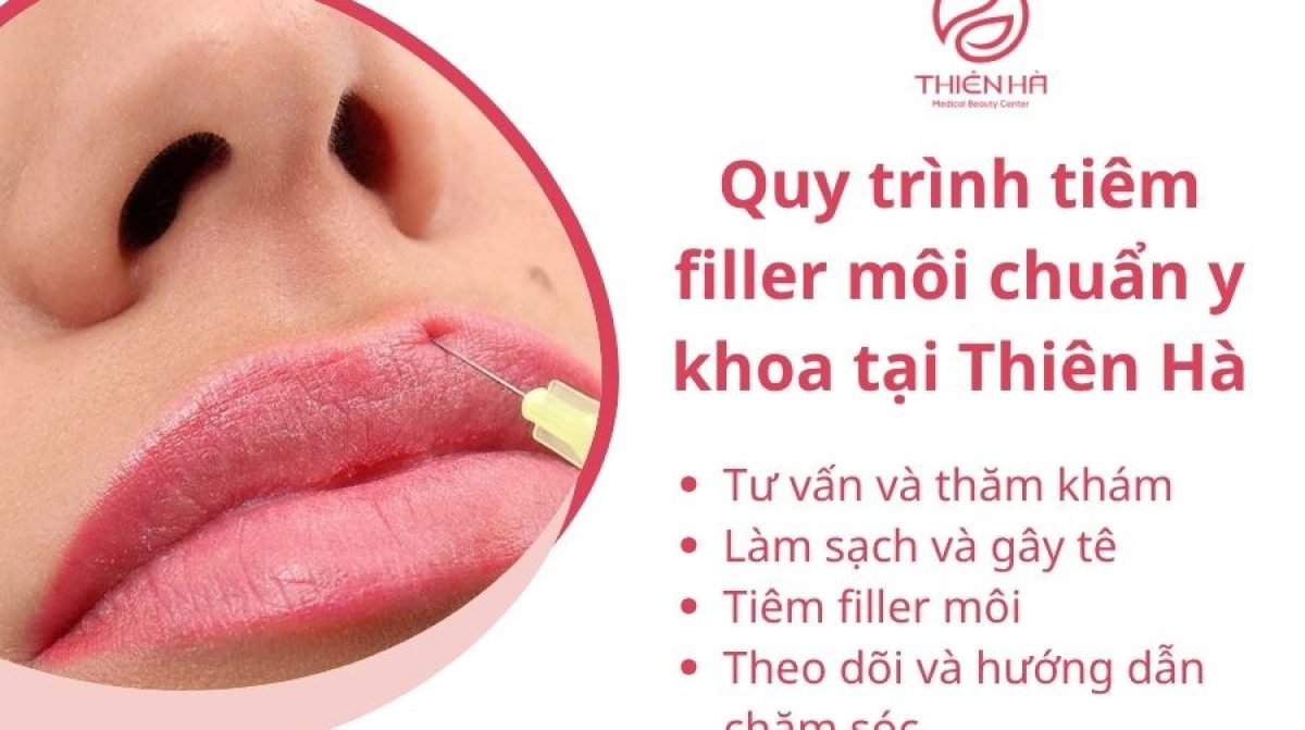 Dáng Môi Tiêm Filler Đẹp Tự Nhiên: Xu Hướng & Lựa Chọn Phù Hợp Cho Khuôn Mặt