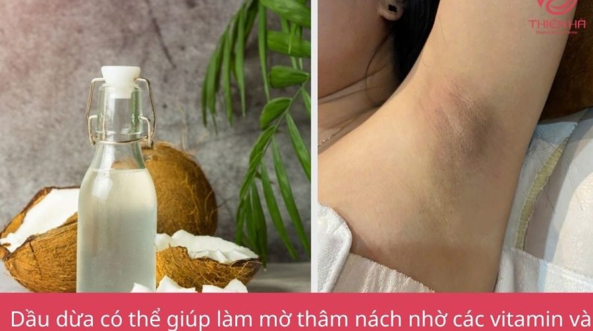 Dầu dừa có trị thâm nách không? Bí quyết an toàn & hiệu quả tại nhà