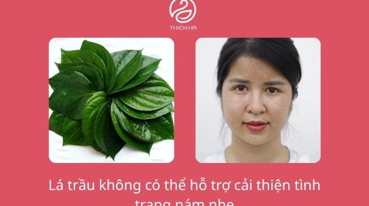Điều trị nám bằng lá trầu không: Hướng dẫn từ A–Z hiệu quả