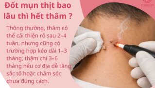 Đốt mụn thịt bao lâu thì hết thâm? Thời gian phục hồi và chăm sóc da