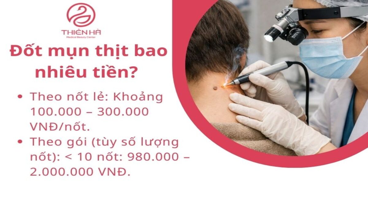 Đốt mụn thịt bao nhiêu tiền? Yếu tố ảnh hưởng và mức giá tham khảo