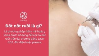 Đốt nốt ruồi có an toàn không? Phương pháp và cách chăm sóc