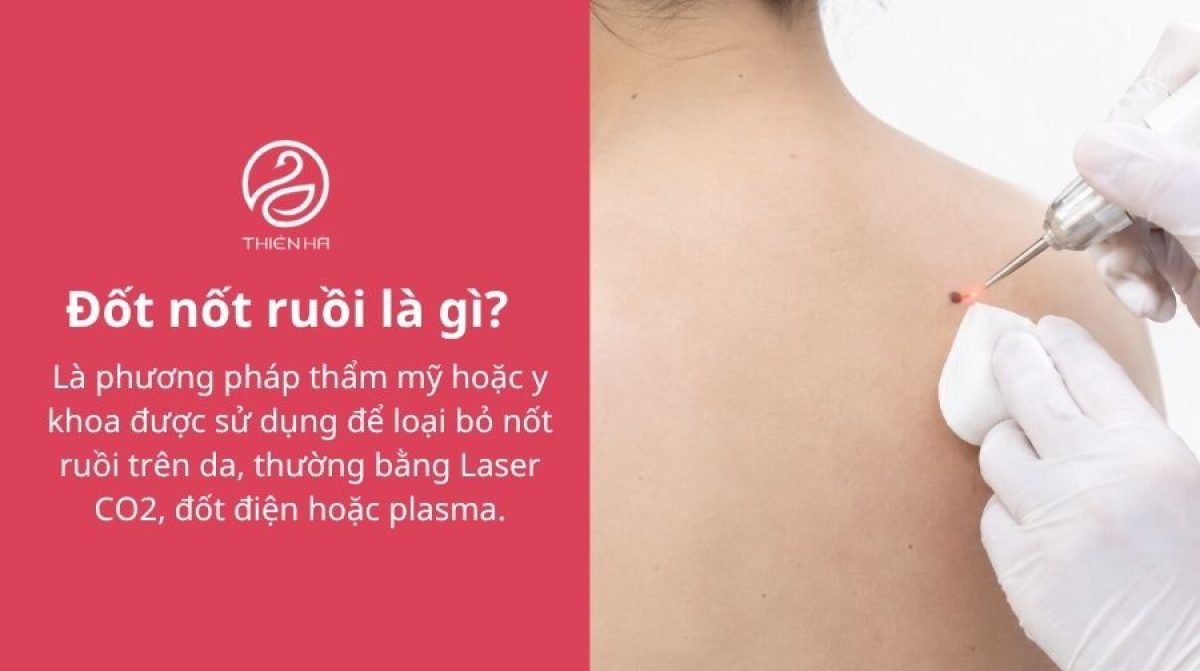 Đốt nốt ruồi có an toàn không? Phương pháp và cách chăm sóc