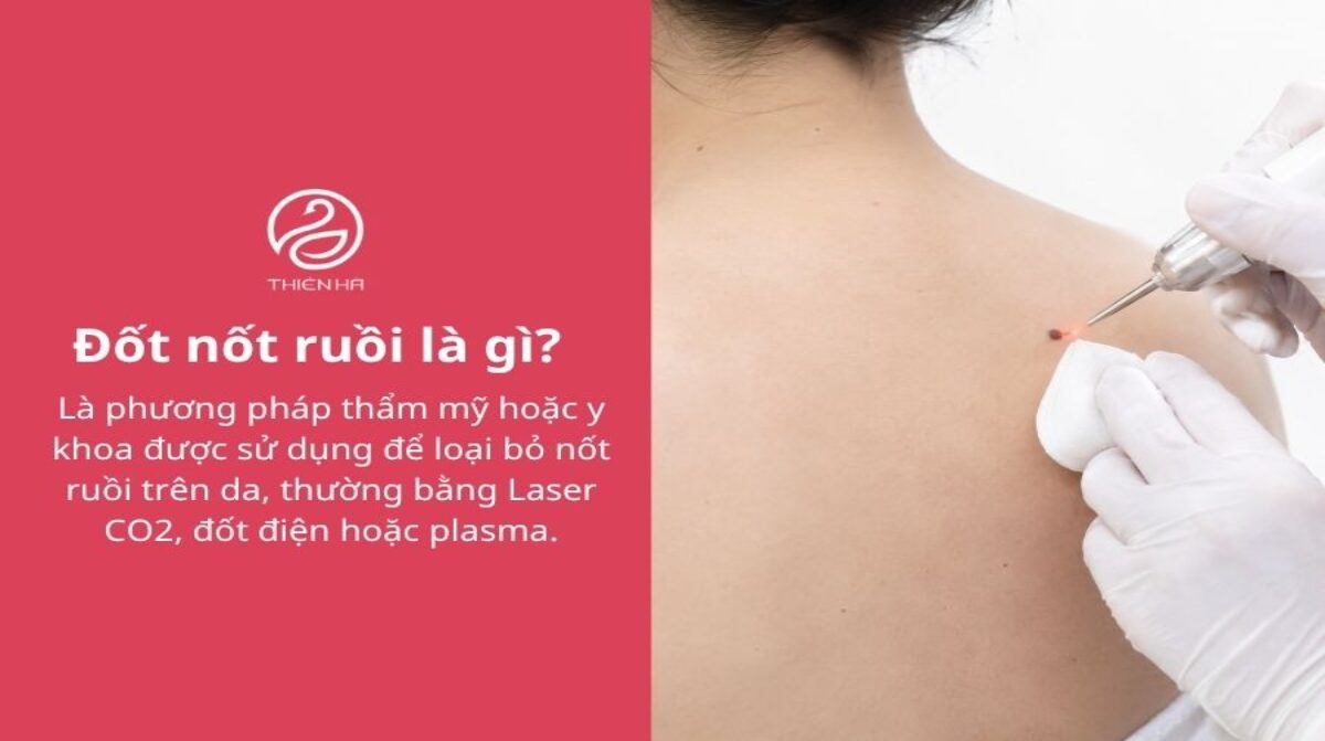 Đốt nốt ruồi có an toàn không? Phương pháp và cách chăm sóc
