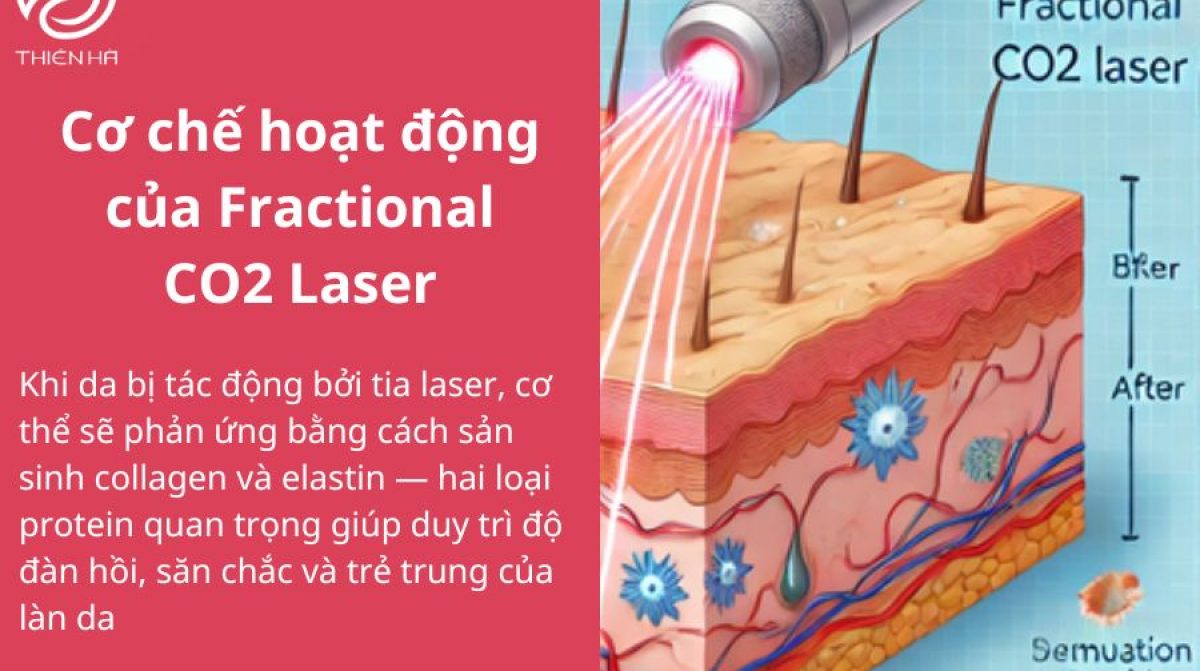 Fractional CO2 Laser: Công nghệ trẻ hóa da hiệu quả và an toàn