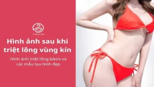 Hình ảnh triệt lông bikini và các mẫu tạo hình đẹp