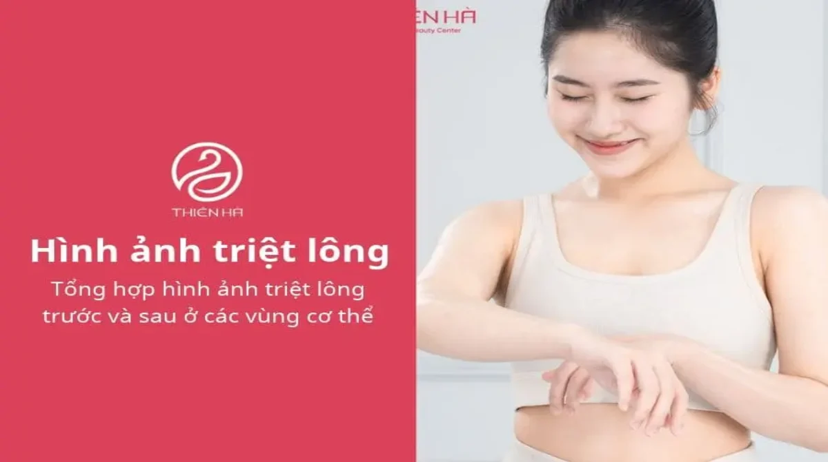 Tổng hợp hình ảnh triệt lông trước và sau ở các vùng cơ thể