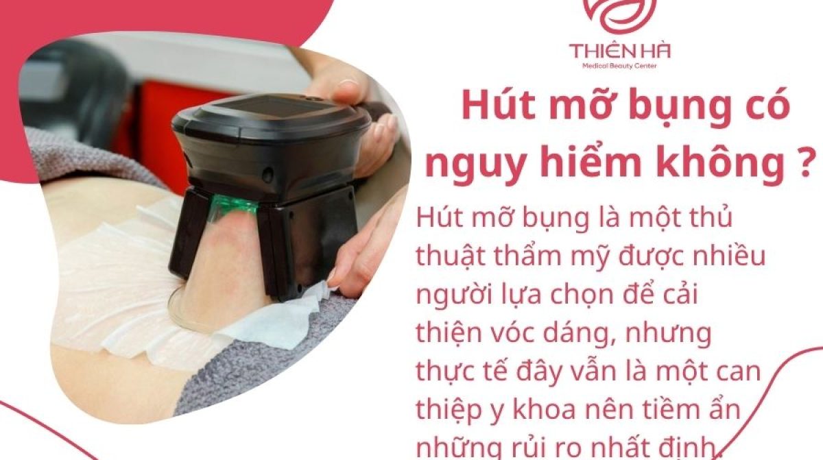 Hút mỡ bụng có nguy hiểm không? Giải đáp từ chuyên gia thẩm mỹ