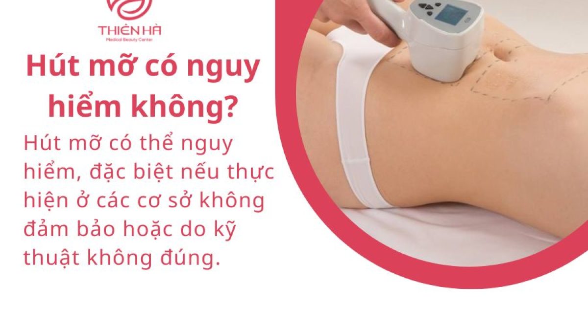 Hút mỡ có nguy hiểm không? Giải đáp từ bác sĩ thẩm mỹ uy tín