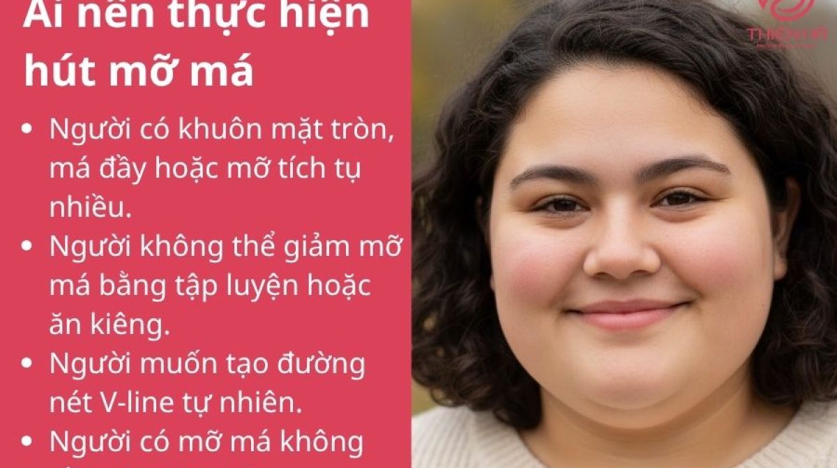 Hút mỡ má an toàn – Giải pháp giúp khuôn mặt thon gọn V-Line