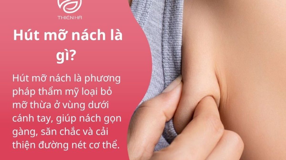 Hút mỡ nách an toàn: Giải pháp loại bỏ mỡ thừa, khử mùi hiệu quả