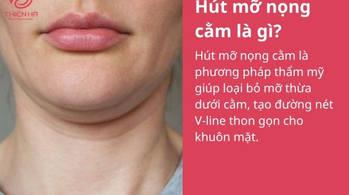 Hút mỡ nọng cằm là gì? Tất tần tật thông tin bạn cần biết