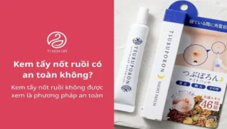 Kem tẩy nốt ruồi: Có an toàn không và nên tẩy bằng cách nào?
