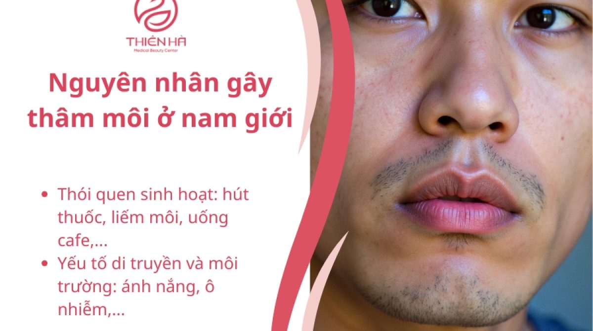 Khử thâm môi nam: Giải pháp hiệu quả cho phái mạnh