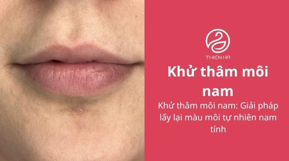 Khử thâm môi nam: Giải pháp lấy lại màu môi tự nhiên nam tính