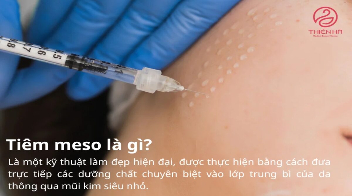 Kỹ thuật tiêm Meso: Giải pháp trẻ hóa da toàn diện
