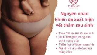 Mẹ bỉm cần biết: Cách làm mờ vết thâm sau sinh nhanh chóng