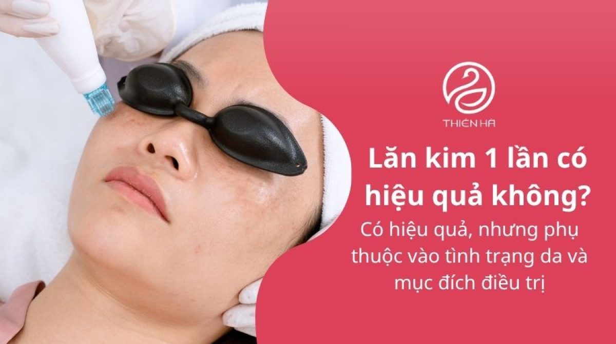 Giải đáp thắc mắc: Lăn kim 1 lần có hiệu quả không?