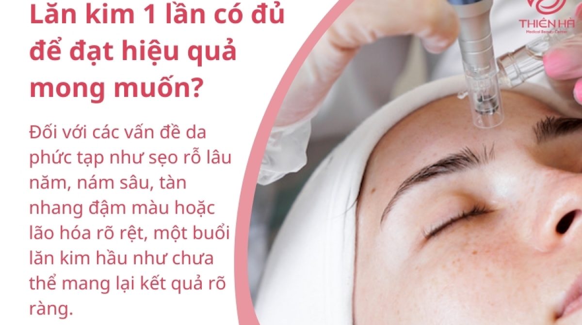 Lăn kim 1 lần có hiệu quả không? Lợi ích và lưu ý quan trọng