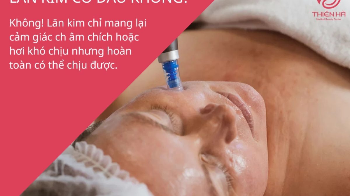 Lăn kim có đau không? Cảm giác thật và cách giảm đau hiệu quả