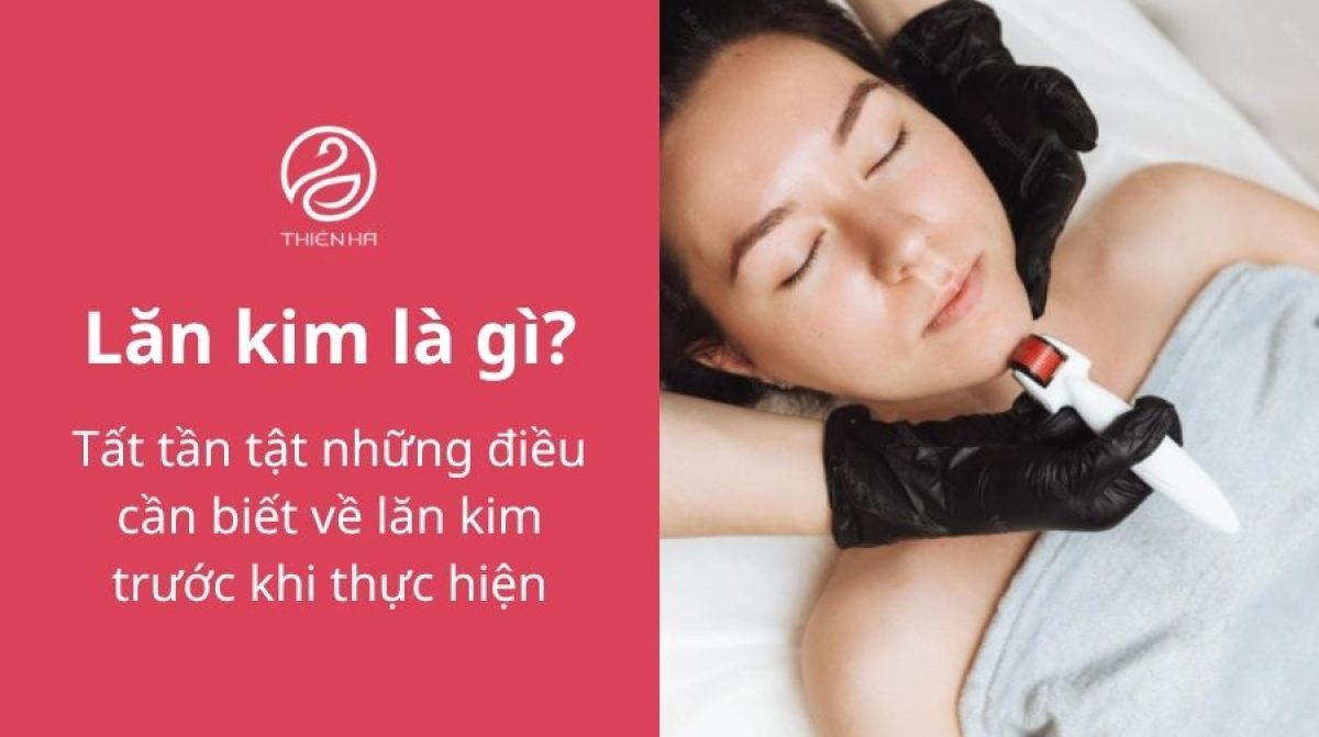 Lăn kim là gì? Tác dụng, quy trình và lưu ý quan trọng