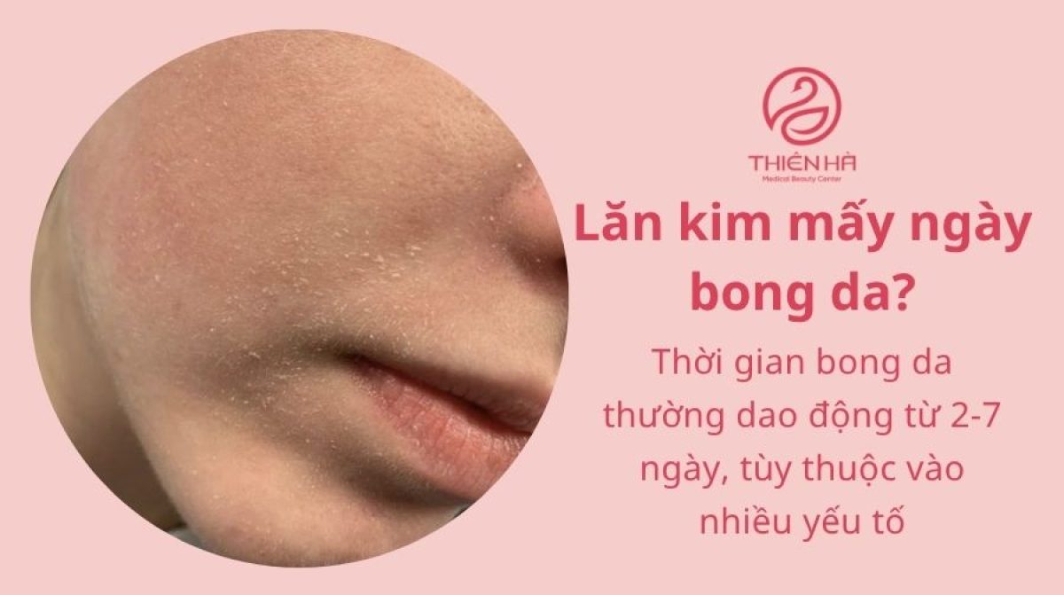Lăn kim mấy ngày bong da? Quy trình & lưu ý