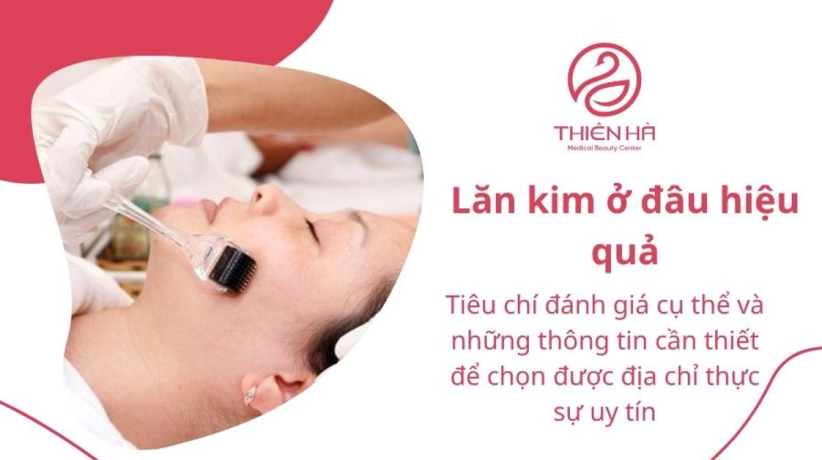 Lăn kim ở đâu hiệu quả và an toàn? Top địa chỉ uy tín
