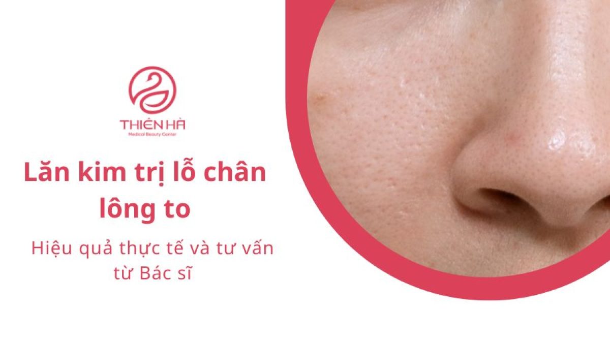 Lăn kim trị lỗ chân lông to: Hiệu quả thực tế và tư vấn từ Bác sĩ