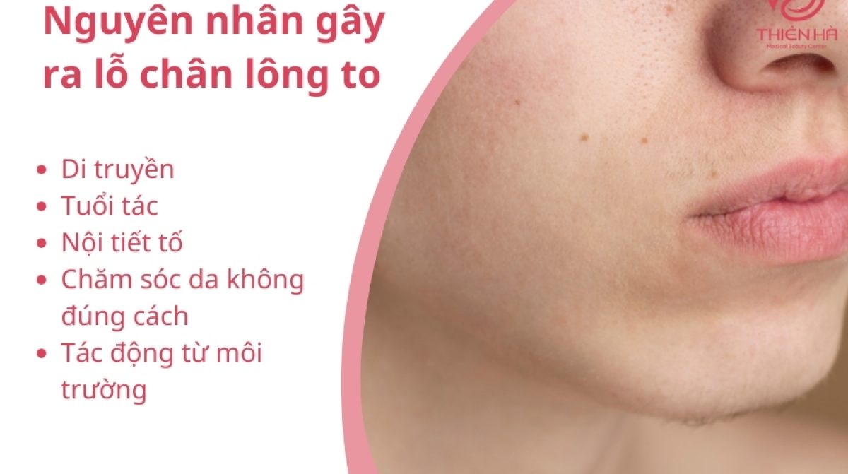 Lăn kim trị lỗ chân lông to: Hiệu quả thật sự và những điều cần biết