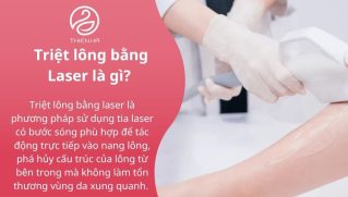 Triệt lông vĩnh viễn bằng Laser: Lợi ích, Quy trình & Chi phí tại TMV Thiên Hà