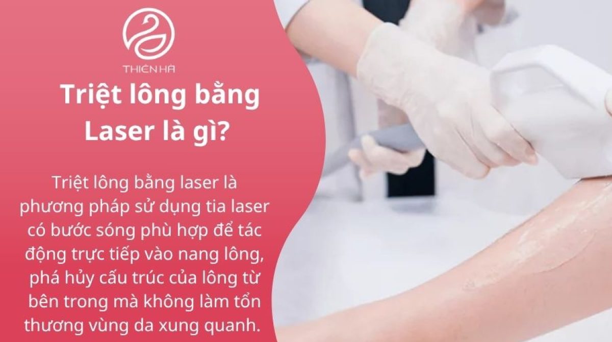 Triệt lông vĩnh viễn bằng Laser: Lợi ích, Quy trình & Chi phí tại TMV Thiên Hà
