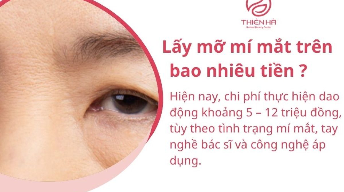 Lấy mỡ mí mắt trên bao nhiêu tiền? Bảng giá chi tiết mới nhất
