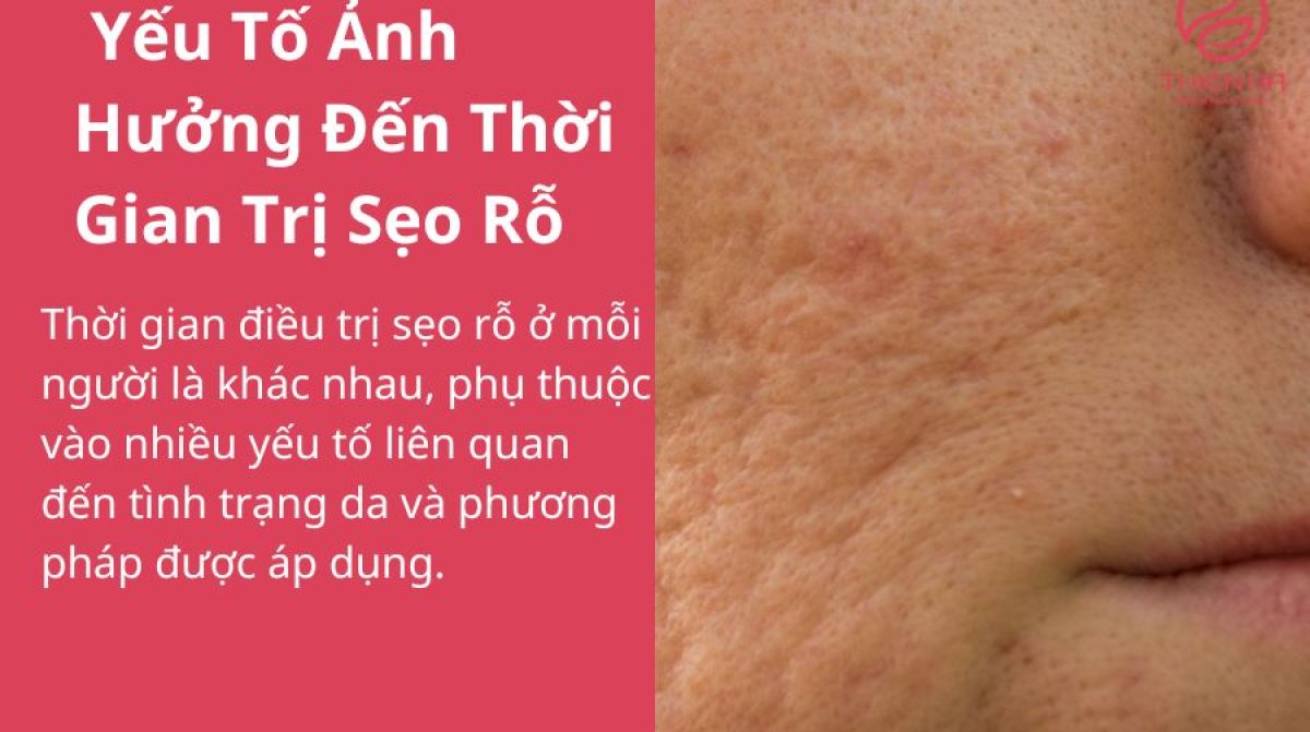 Liệu Trình Trị Sẹo Rỗ Bao Lâu Thì Hiệu Quả? | Thiên Hà Spa