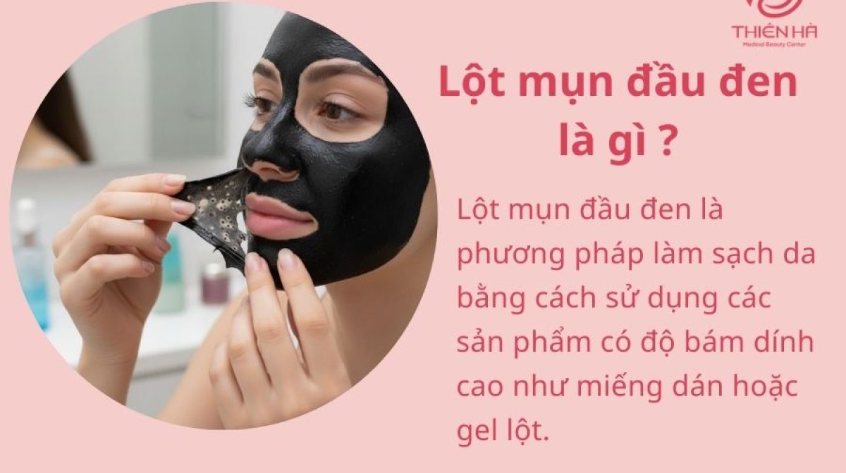 Lột mụn đầu đen an toàn và hiệu quả: Quy trình chi tiết từng bước