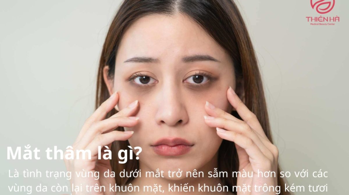 Mắt thâm thiếu vitamin gì? Nguyên nhân & cách khắc phục