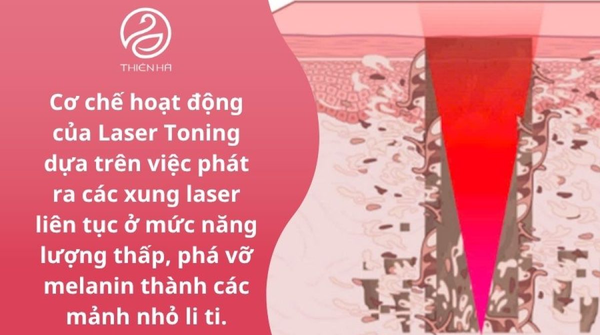 Laser Toning là gì? Công nghệ, hiệu quả và chi phí điều trị