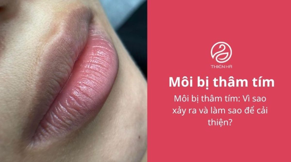 Môi bị thâm tím: Vì sao xảy ra và làm sao để cải thiện?