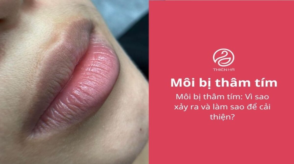 Môi bị thâm tím: Vì sao xảy ra và làm sao để cải thiện?