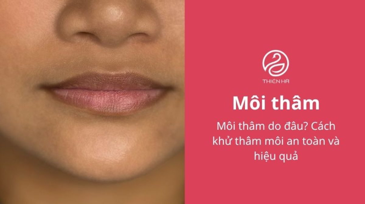 Môi thâm do đâu? Cách khử thâm môi an toàn và hiệu quả