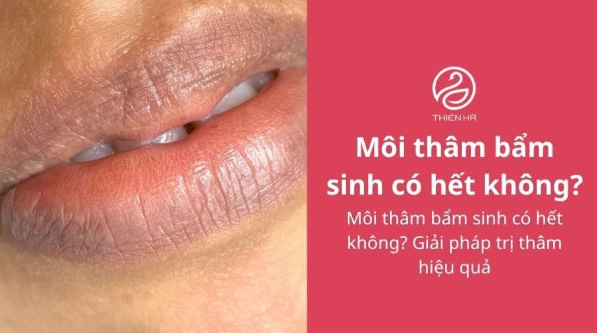 Môi thâm bẩm sinh có hết không? Giải pháp trị thâm hiệu quả
