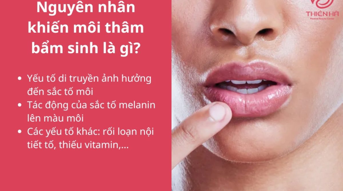 Môi thâm bẩm sinh có hết không? Giải pháp trị thâm hiệu quả