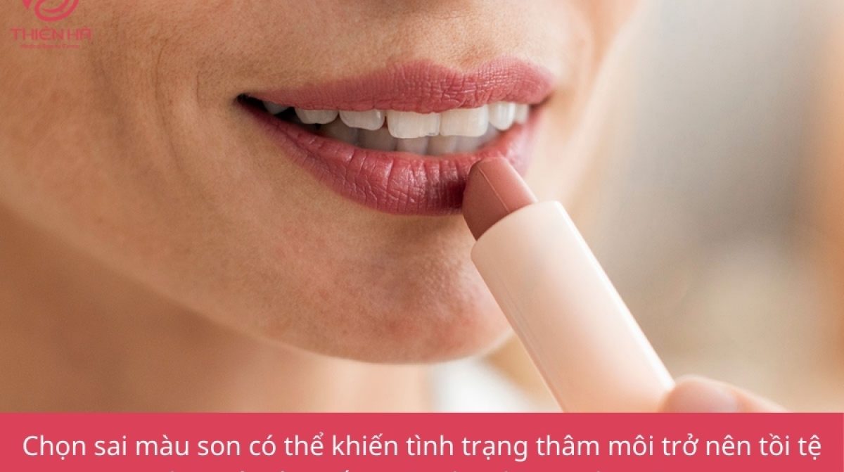 Môi thâm nên dùng son màu gì? 9 lựa chọn hoàn hảo cho bạn