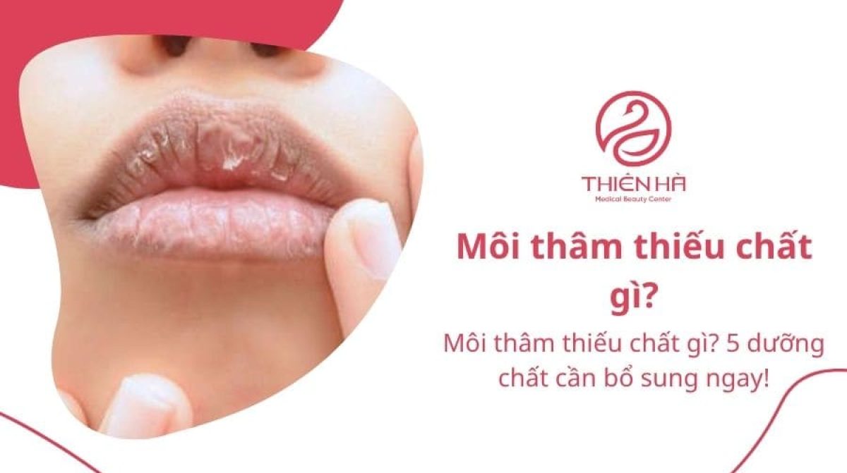Môi thâm thiếu chất gì? 5 dưỡng chất cần bổ sung ngay!