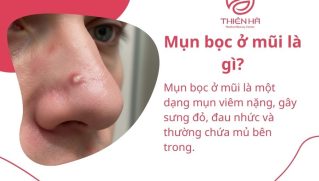 Mụn bọc ở mũi: Dấu hiệu nhận biết, nguyên nhân và cách xử lý hiệu quả