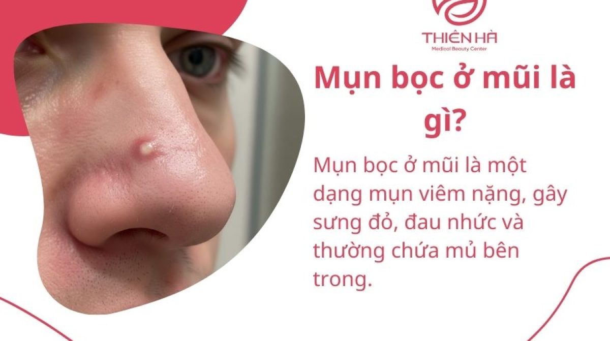 Mụn bọc ở mũi: Dấu hiệu nhận biết, nguyên nhân và cách xử lý hiệu quả