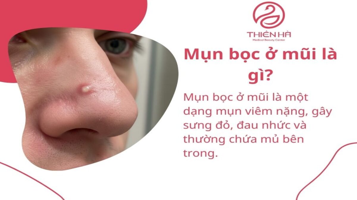Mụn bọc ở mũi: Dấu hiệu nhận biết, nguyên nhân và cách xử lý hiệu quả