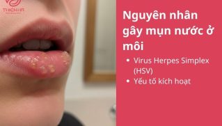 Mụn nước ở môi: Nhận biết, chăm sóc và phòng ngừa tái phát