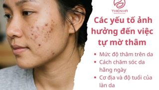 Mụn thâm có tự hết không? Cách mờ thâm nhanh và tránh tái phát